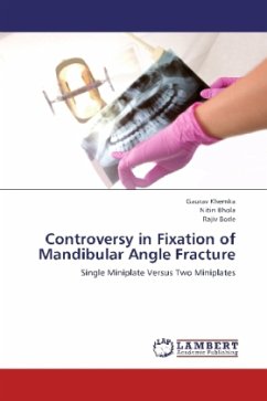 Controversy in Fixation of Mandibular Angle Fracture - Khemka, Gaurav;Bhola, Nitin;Borle, Rajiv
