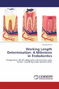 Working Length Determination: A Milestone in Endodontics - Ehsan, Saroosh