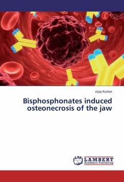 Bisphosphonates induced osteonecrosis of the jaw - Kumar, Vijay