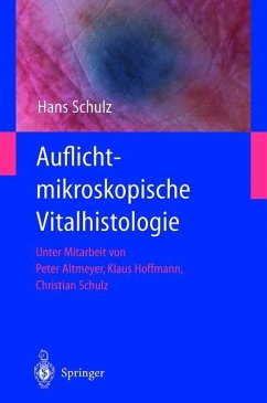 Auflichtmikroskopische Vitalhistologie - Schulz, Hans