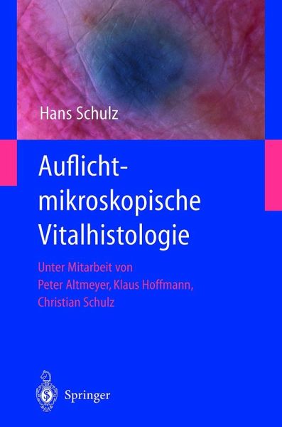 Auflichtmikroskopische Vitalhistologie Auflichtmikroskopische Vitalhistologie