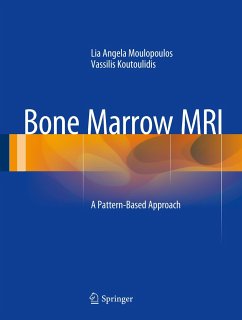 Bone Marrow MRI - Moulopoulos, Lia Angela;Koutoulidis, Vassilis