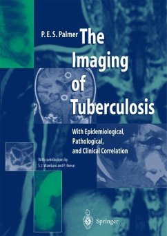 The Imaging of Tuberculosis - Palmer, P.E.S.