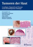 Tumoren der Haut (eBook, PDF)