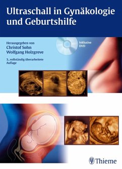 Ultraschall in Gynäkologie und Geburtshilfe (eBook, PDF)