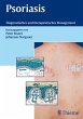 Psoriasis (eBook, PDF) - Bild 1