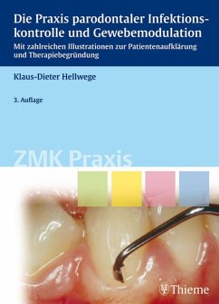 Die Praxis parodontaler Infektionskontrolle und Gewebemodulation (eBook, PDF) - Hellwege, Klaus-Dieter