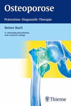 Osteoporose (eBook, PDF) - Bartl, Reiner