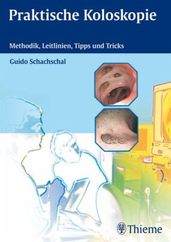 Praktische Koloskopie (eBook, PDF) - Schachschal, Guido