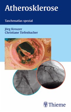 Atherosklerose (eBook, PDF) - Kreuzer, Jörg; Tiefenbacher, Christiane