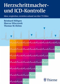 Herzschrittmacher- und ICD-Kontrolle (eBook, PDF) - Höltgen, Reinhard; Wieczorek, Marcus; Helms, Thomas M.