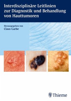 Interdisziplinäre Leitlinien zur Diagnostik und Behandlung von Hauttumoren (eBook, PDF)