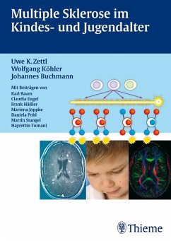Multiple Sklerose im Kinder- und Jugendalter Mit Beiträgen von Karl Braun, Clau (eBook, PDF) - Buchmann, Johannes; Köhler, Wolfgang; Zettl, Uwe Klaus