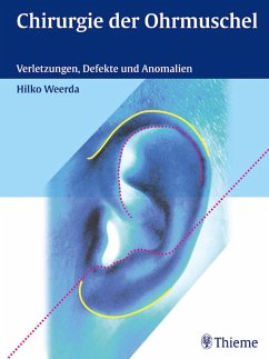 Chirurgie der Ohrmuschel (eBook, PDF) - Weerda, Hilko