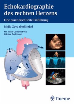 Echokardiographie des rechten Herzens (eBook, PDF) - Zeydabadinejad, Majid