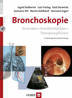 Bronchoskopie (eBook, PDF) - Darwiche, Kaid; Dobbertin, Ingrid; Freitag, Lutz; Ingerl, Hermann; Kohlhäufl, Martin; Ott, Germann