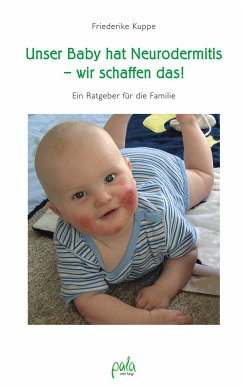 Unser Baby hat Neurodermitis - wir schaffen das! (eBook, PDF) - Kuppe, Friederike