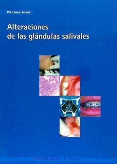 Alteraciones de las glándulas salivales - López Jornet, P.