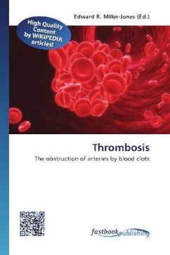 Thrombosis