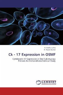Ck - 17 Expression in OSMF