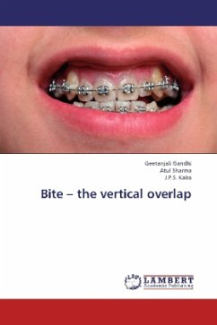 Bite - the vertical overlap
