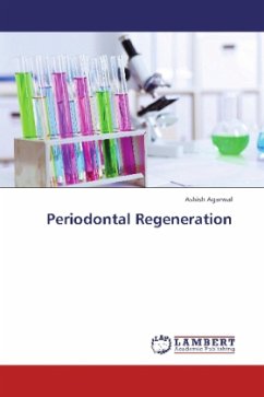 Periodontal Regeneration - Agarwal, Ashish