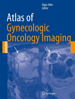 Atlas of Gynecologic Oncology Imaging