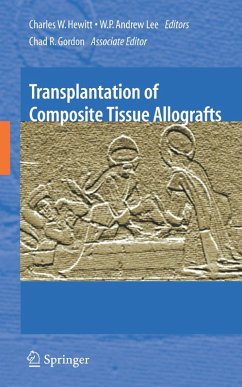 Transplantation of Composite Tissue Allografts (eBook, PDF)