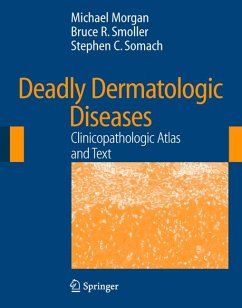 Deadly Dermatologic Diseases (eBook, PDF) - Morgan, Michael; Smoller, Bruce R.; Somach, Stephen C.