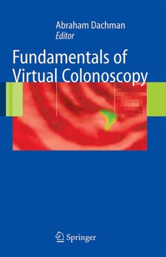 Fundamentals of Virtual Colonoscopy (eBook, PDF)