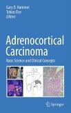 Adrenocortical Carcinoma (eBook, PDF)