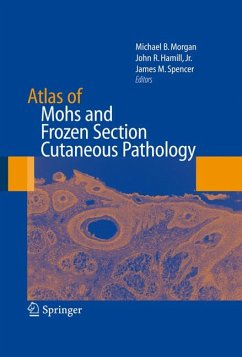 Atlas of Mohs and Frozen Section Cutaneous Pathology (eBook, PDF)