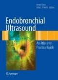 Endobronchial Ultrasound (eBook, PDF)