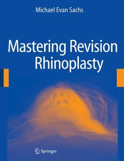 Mastering Revision Rhinoplasty (eBook, PDF) - Sachs, Michael Evan