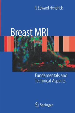 Breast MRI (eBook, PDF) - Hendrick, R. Edward