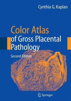 Color Atlas of Gross Placental Pathology (eBook, PDF) - Kaplan, Cynthia G.