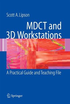 MDCT and 3D Workstations (eBook, PDF) - Lipson, Scott A.