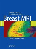 Breast MRI (eBook, PDF)