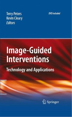 Image-Guided Interventions (eBook, PDF)