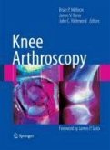 Knee Arthroscopy (eBook, PDF)
