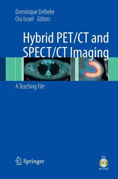 Hybrid PET/CT and SPECT/CT Imaging (eBook, PDF)