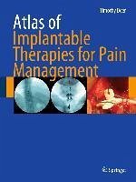 Atlas of Implantable Therapies for Pain Management (eBook, PDF) - Deer, Timothy R