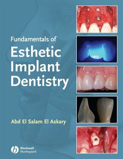 Fundamentals of Esthetic Implant Dentistry (eBook, PDF) - Elaskary, Abdelsalam