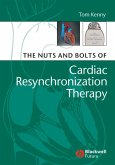 The Nuts and Bolts of Cardiac Resynchronization Therapy (eBook, PDF)