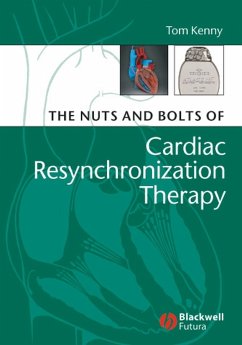 The Nuts and Bolts of Cardiac Resynchronization Therapy (eBook, PDF) - Kenny, Tom