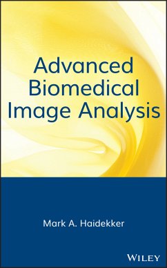 Advanced Biomedical Image Analysis (eBook, PDF) - Haidekker, Mark