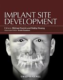 Implant Site Development (eBook, ePUB)