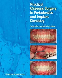 Practical Osseous Surgery in Periodontics and Implant Dentistry (eBook, ePUB) - Dibart, Serge; Dibart, Jean-Pierre
