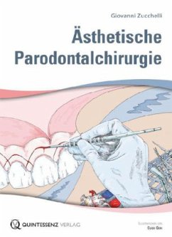 Ästhetische Parodontalchirurgie, Buch + Lehrtafeln - Zucchelli, Giovanni