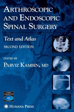 Arthroscopic and Endoscopic Spinal Surgery (eBook, PDF)